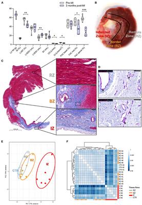 Unraveling the Metabolic Derangements Occurring in Non-infarcted Areas of Pig Hearts With Chronic Heart Failure